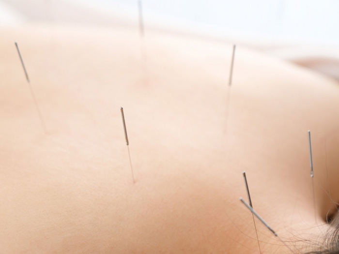 東洋医学鍼灸の実践